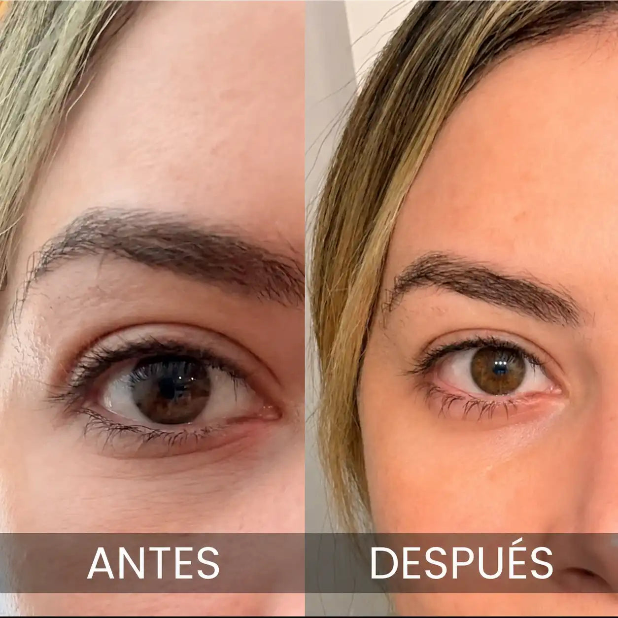 PDRN MULTI Bálsamo Volumen y Brillo Sin Agujas Lisse