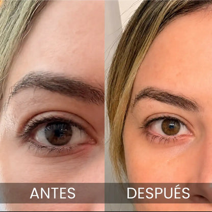 PDRN MULTI Bálsamo Volumen y Brillo Sin Agujas Lisse