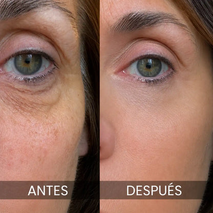 PDRN MULTI Bálsamo Volumen y Brillo Sin Agujas Lisse