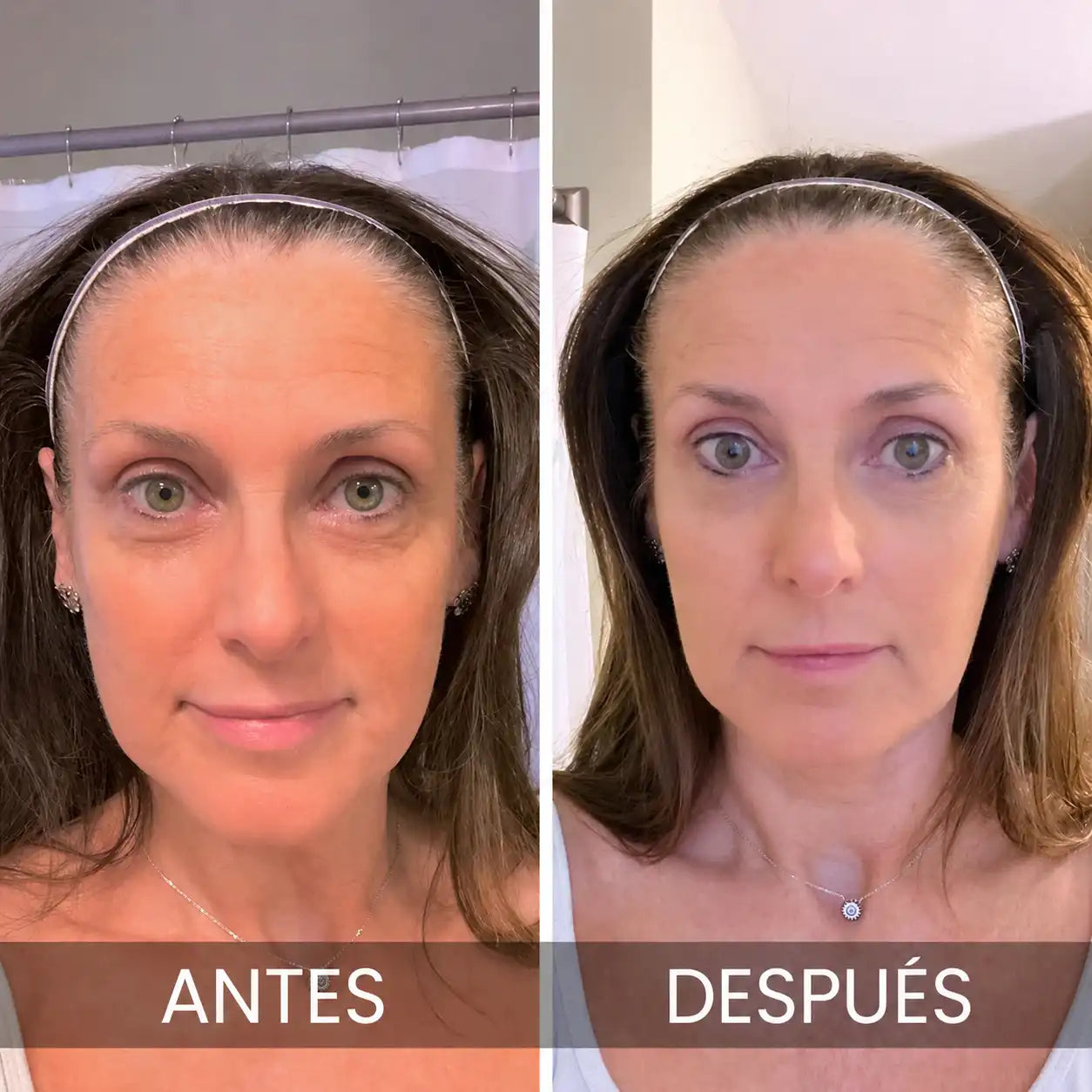 PDRN MULTI Bálsamo Volumen y Brillo Sin Agujas Lisse