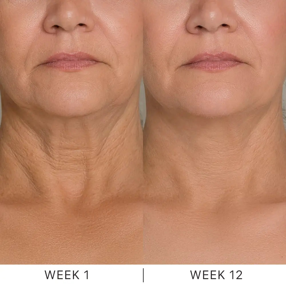 Dermave™ K-Lift Cream