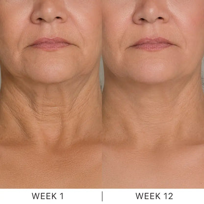 Dermave™ K-Lift Cream