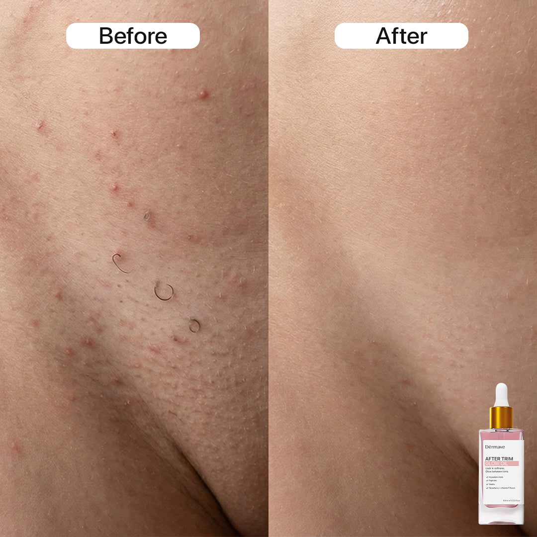 Dermave™ Full Routine Bundle