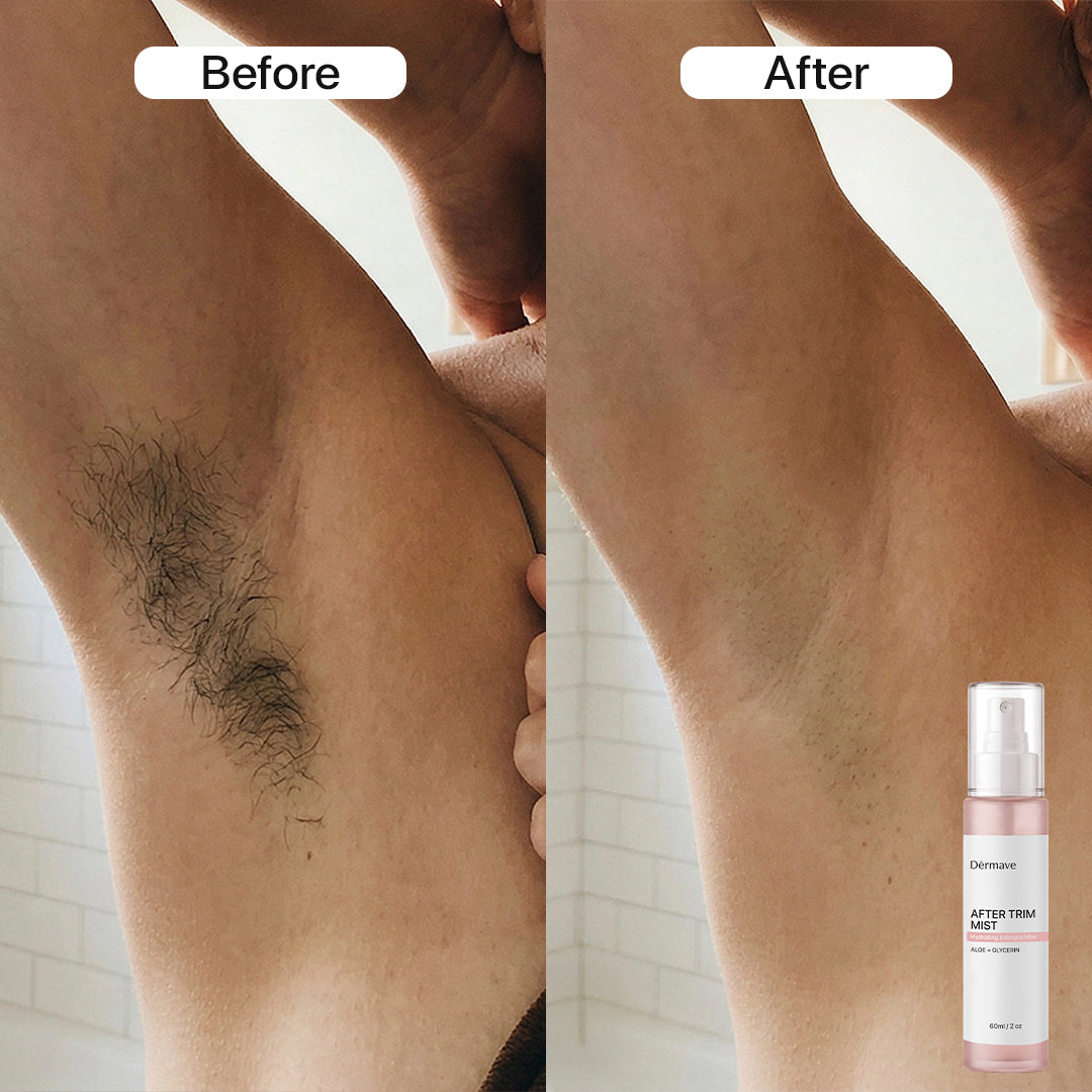 Dermave™ Pre + Post Trim Essentials