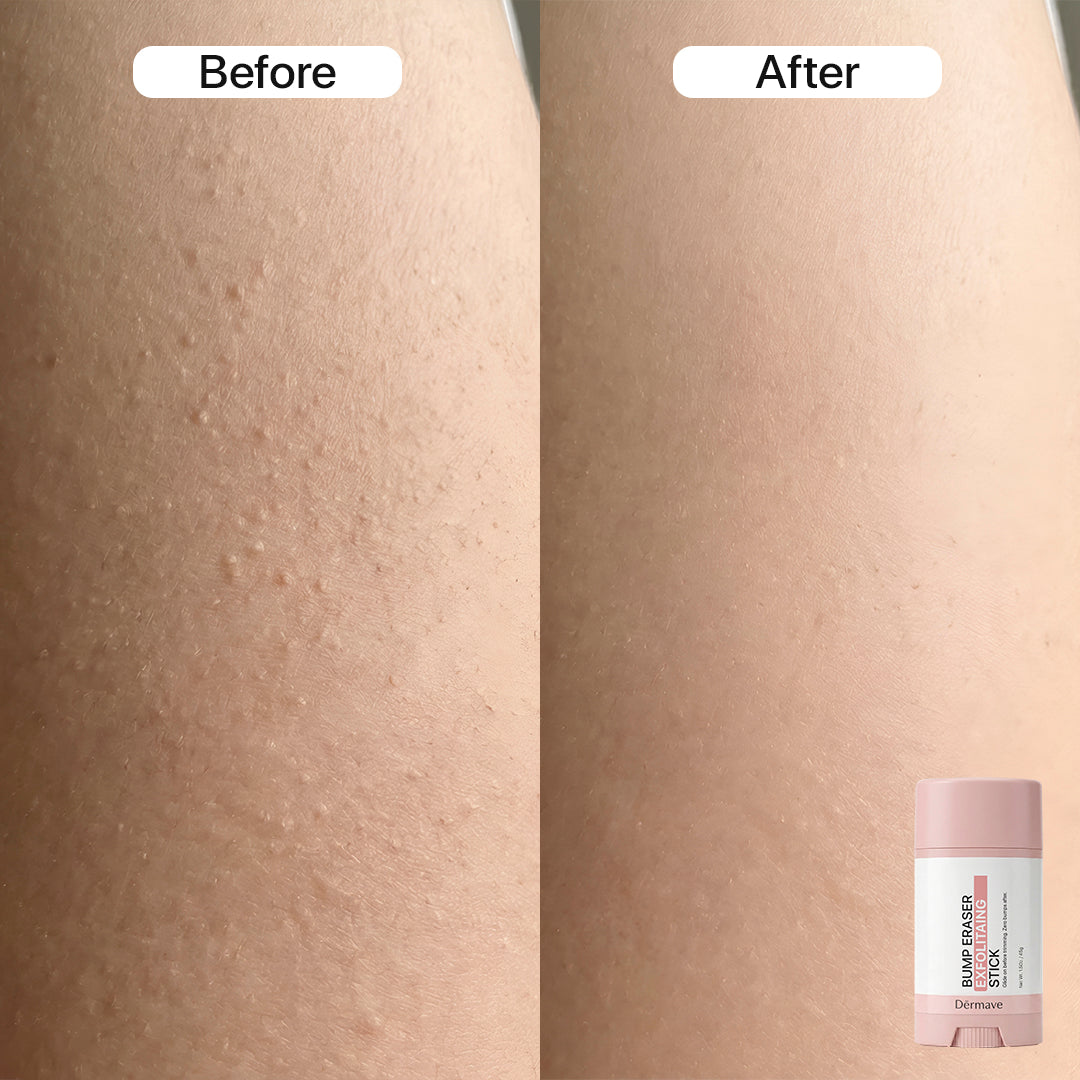 Dermave™ Full Routine Bundle