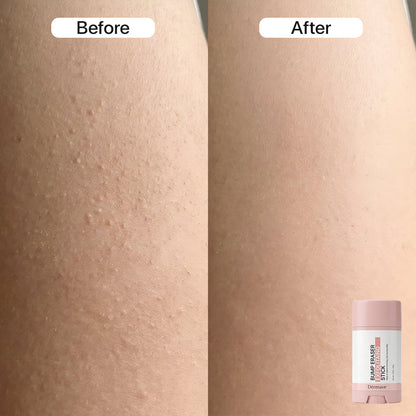 Dermave™ Pre + Post Trim Essentials