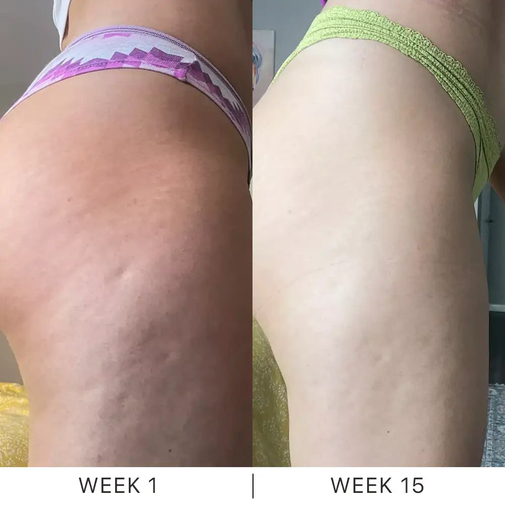 Dermave™ K-Lift Cream