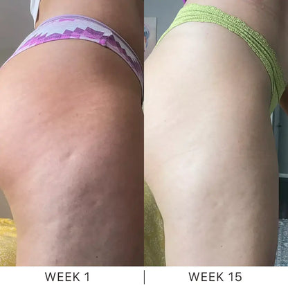 Dermave™ K-Lift Cream