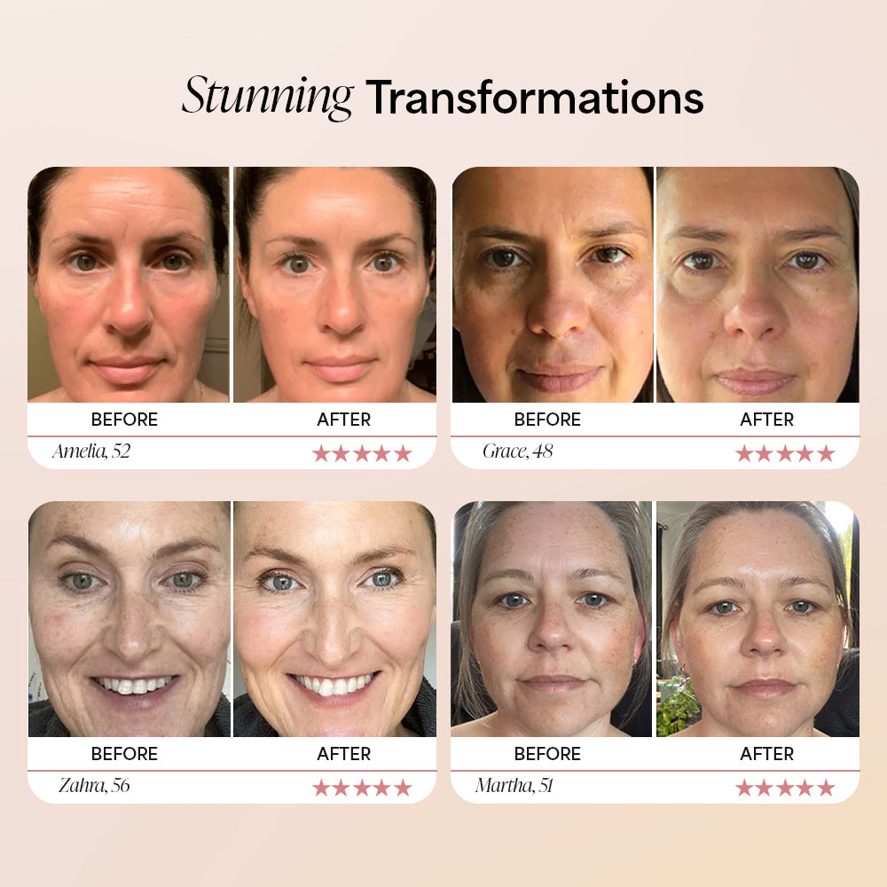 Dermave™ Deep Collagen Mask