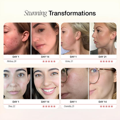 Dermave™