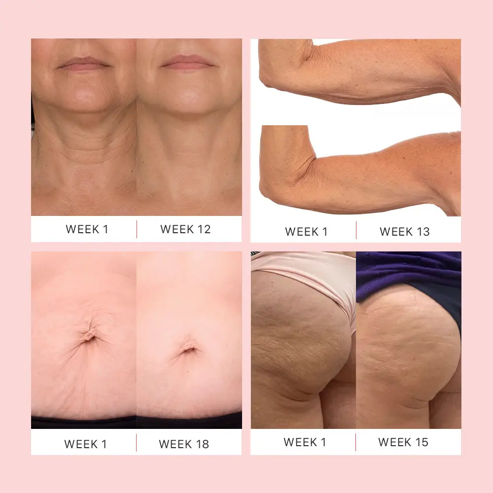 Dermave™ K-Lift Cream