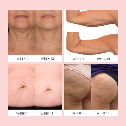 Dermave™ K-Lift Cream